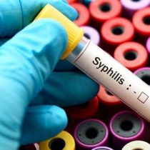 Alertan que aumento de sífilis se debe a la ausencia de educación sexual con enfoque inclusivo y libre de prejuicios