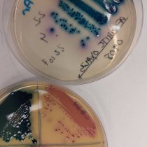 La carrera científica contra las bacterias multirresistentes