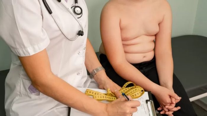 Las polémicas nuevas recomendaciones de los pediatras en EE.UU. para tratar la obesidad infantil
